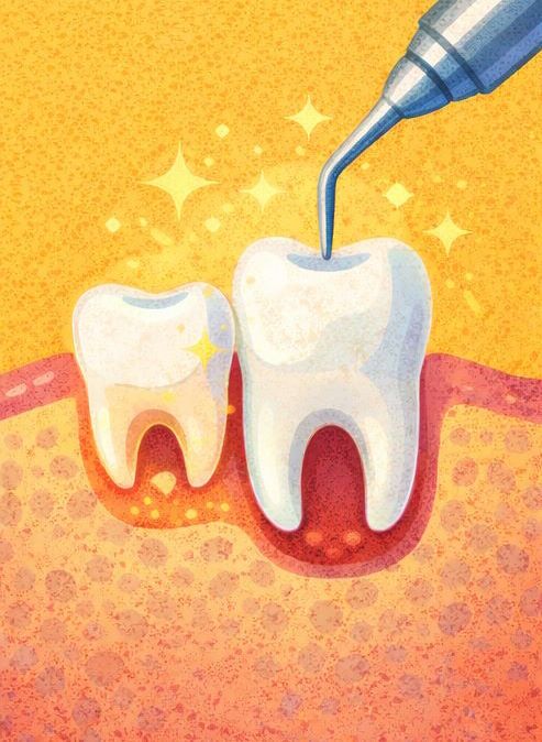 Лечение молочных и постоянных зубов